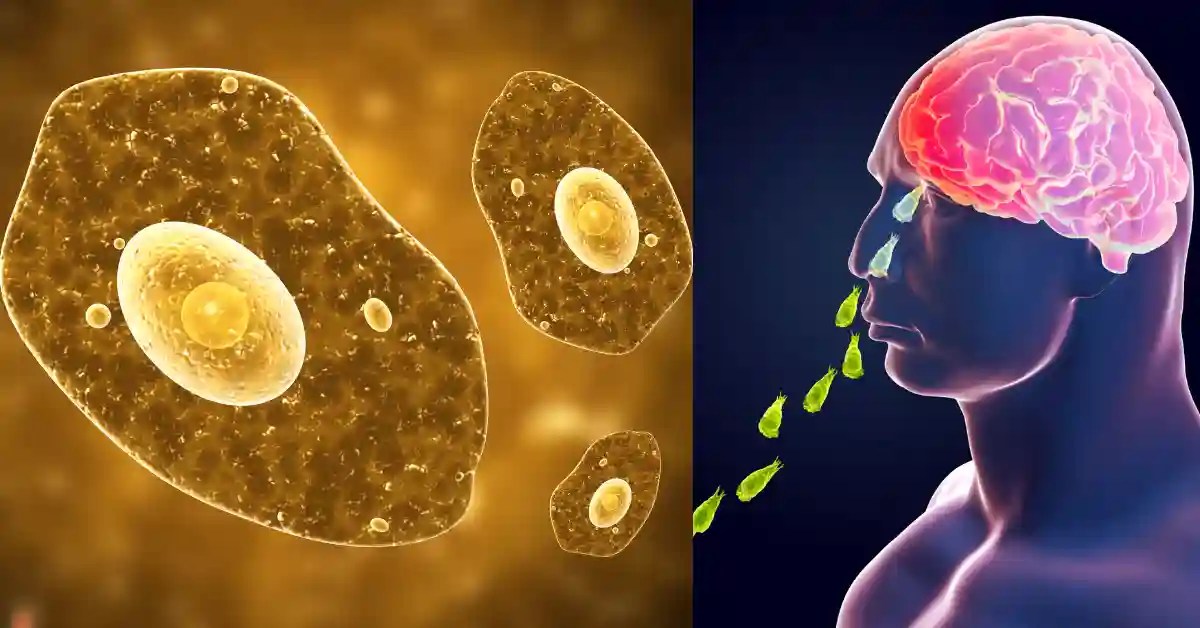 அமீபா பாதிப்பு: கேரளாவில் பரபரப்பு அமீபா பாதிப்பு: கேரளாவில் பரபரப்பு